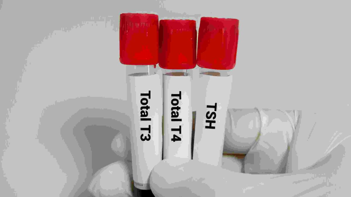 tsh levels and thyronorm dosage chart