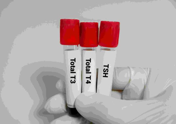 tsh levels and thyronorm dosage chart